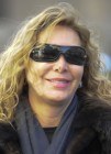 Norma Duval y su sospechoso rostro hinchado